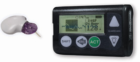 The Medtronic Guardian&reg; REAL-Time CGMS