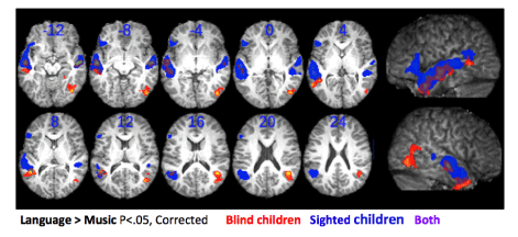 Twelve images of the brains of blind and sighted children, show the areas activated by language and music.
