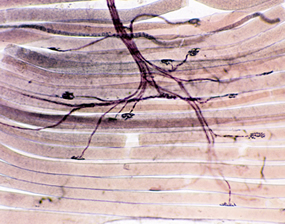 3D print of neuromuscular junction slide which compares the accuracy of the 3D print with the 2D photo.